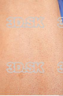 Skin texture of Alberto 0002